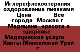 Иглорефлексотерапия, оздоровление пиявками › Цена ­ 3 000 - Все города, Москва г. Медицина, красота и здоровье » Медицинские услуги   . Ханты-Мансийский,Урай г.